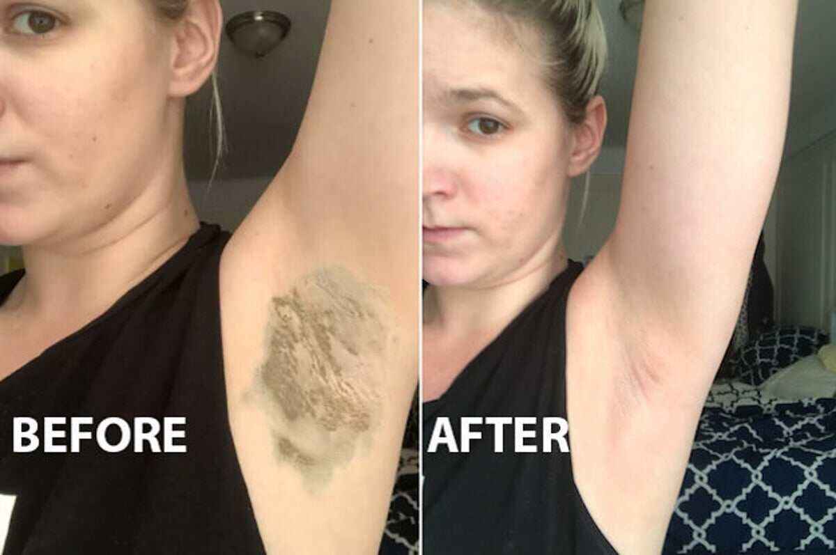 Armpit Detox Work