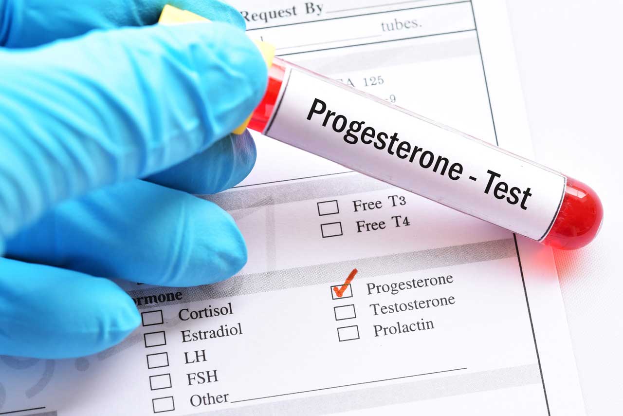 Progesterone Levels
