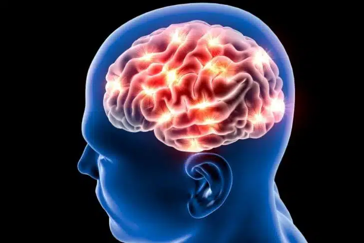 Alzheimer's disease
