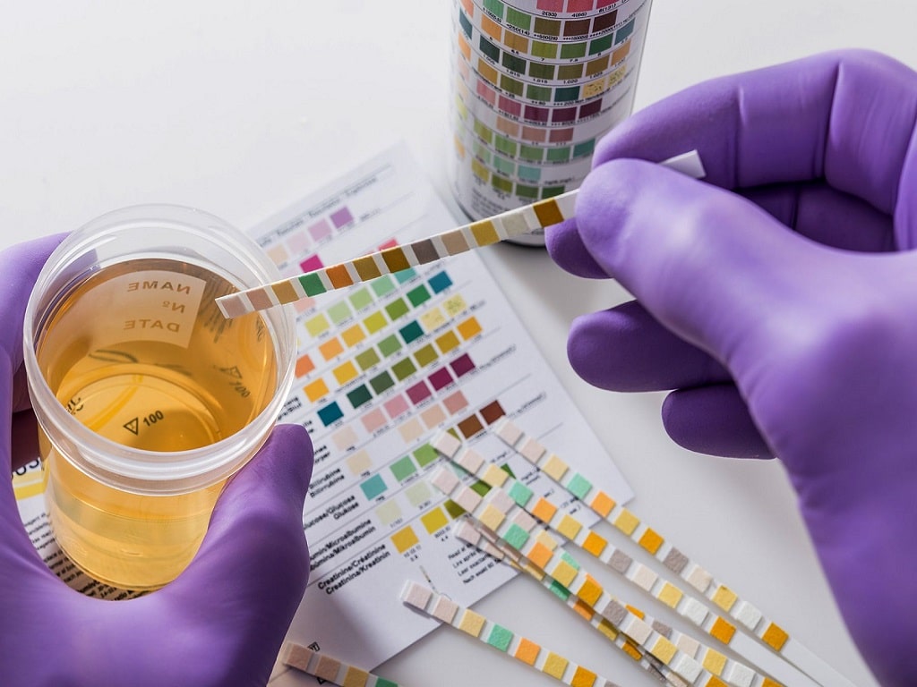 How to Pass Urine Drug Test