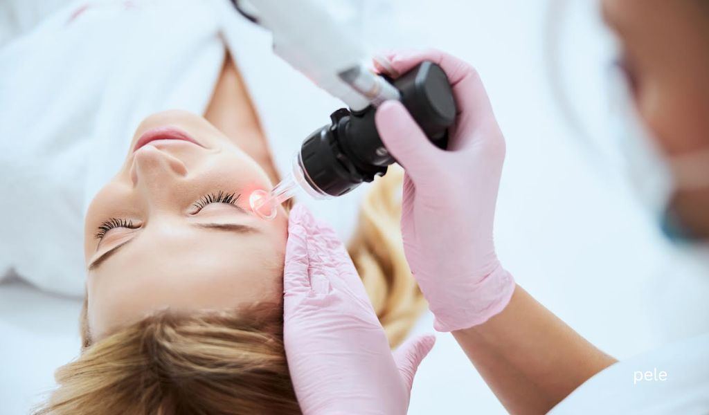 Tips for Choosing a Dermatologist