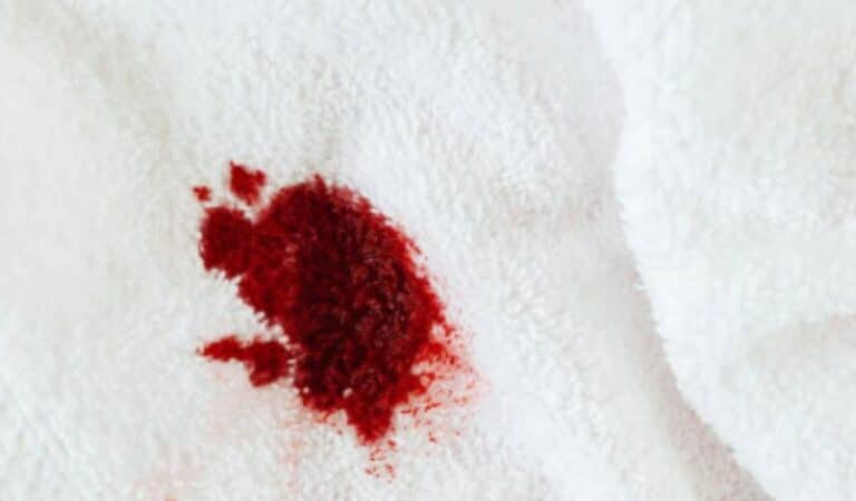 how-to-remove-blood-stains-from-sheets-and-mattress-editorialge