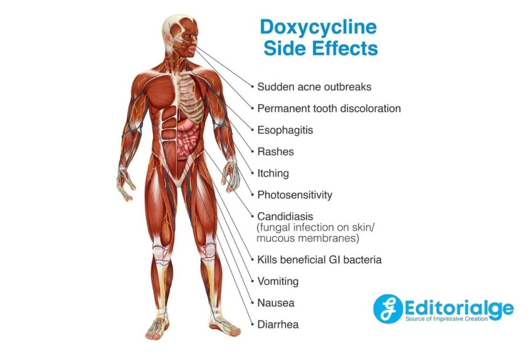 doxycycline-ruined-my-life-should-you-take-this-antibiotic