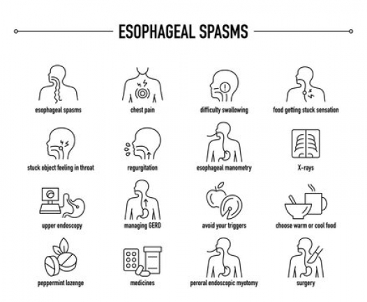 esophageal spasm symptom