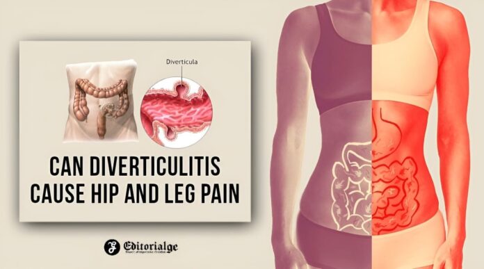 Can diverticulitis cause hip and leg pain