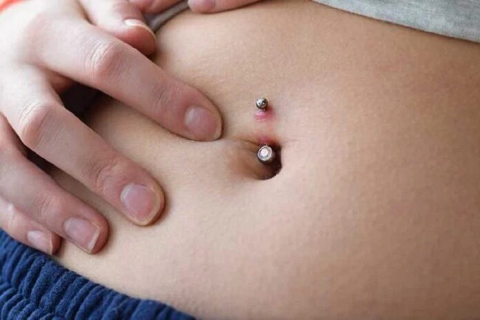 Infected Belly Button Piercings