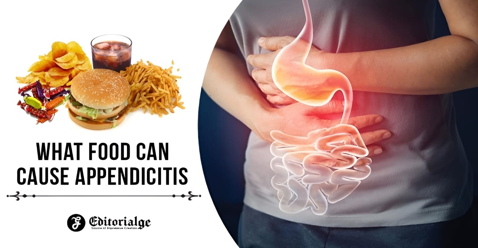 What Food Can Cause Appendicitis