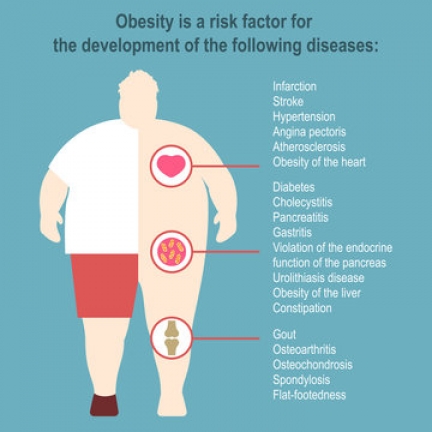 risk of obesity