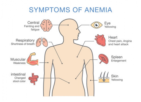 symptoms of anemia