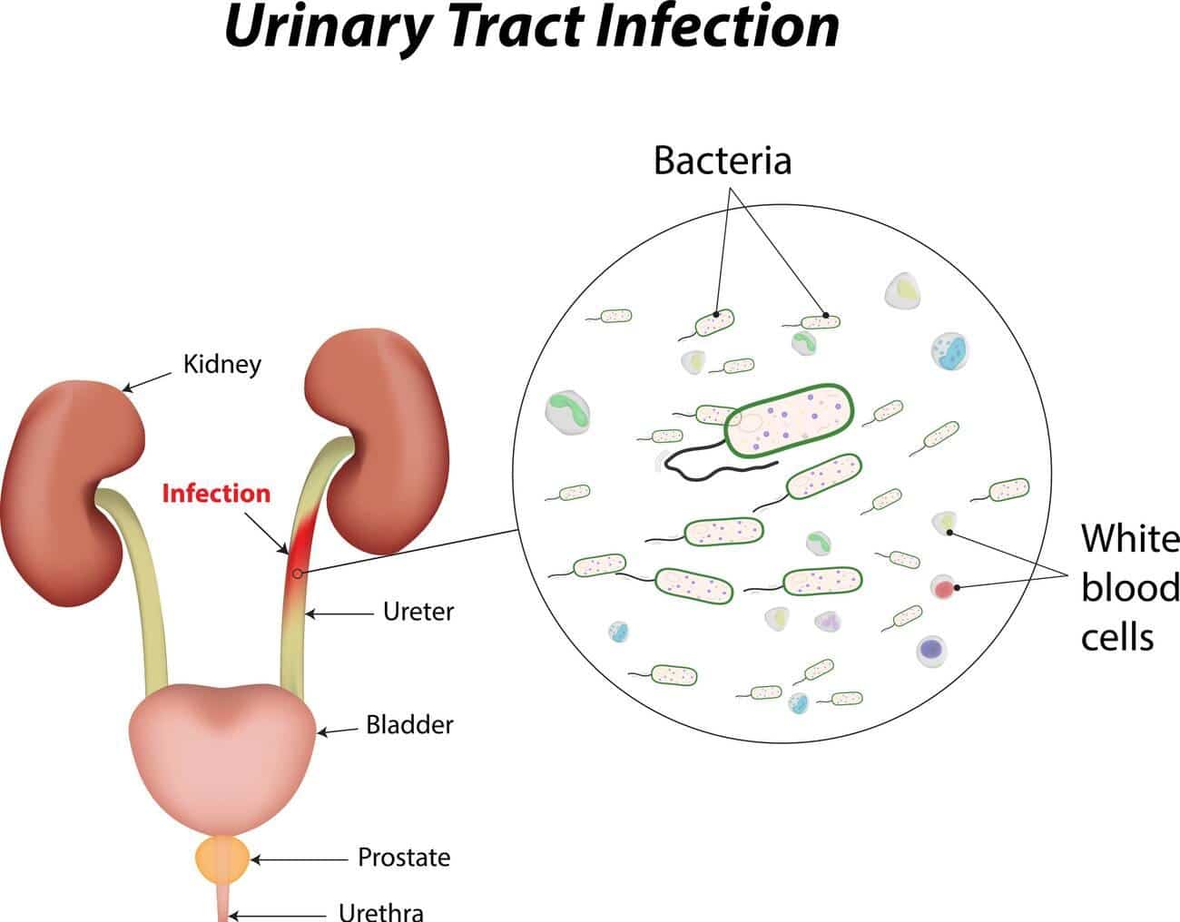 urinary tract information