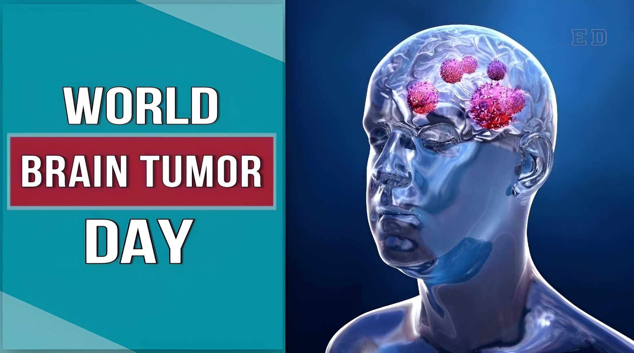 World Brain Tumor Day 2023 History, Significance, and Wishes