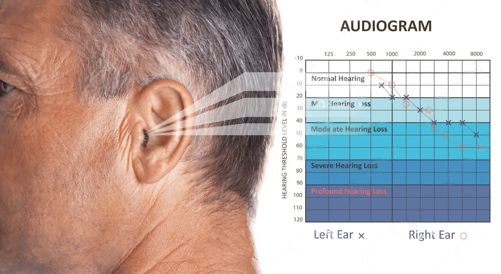 audiogram