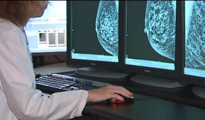 AI in Breast Cancer Screening
