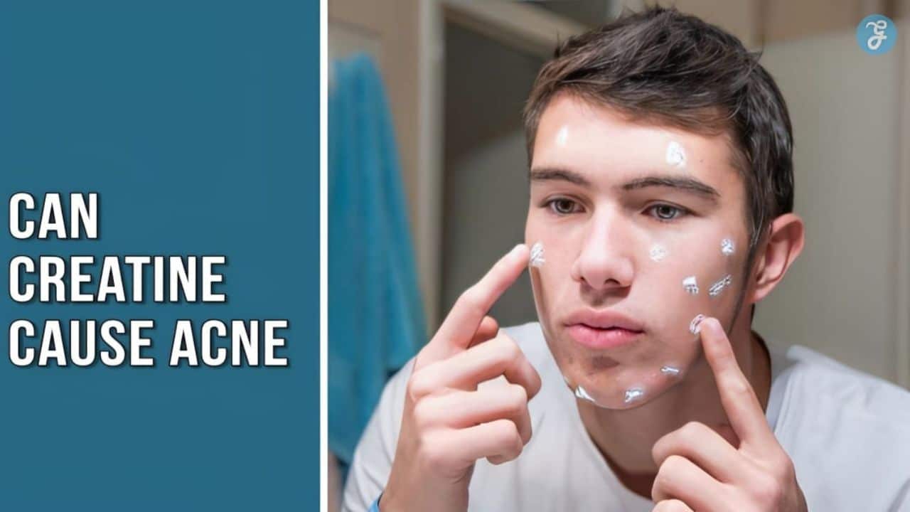Can creatine cause acne