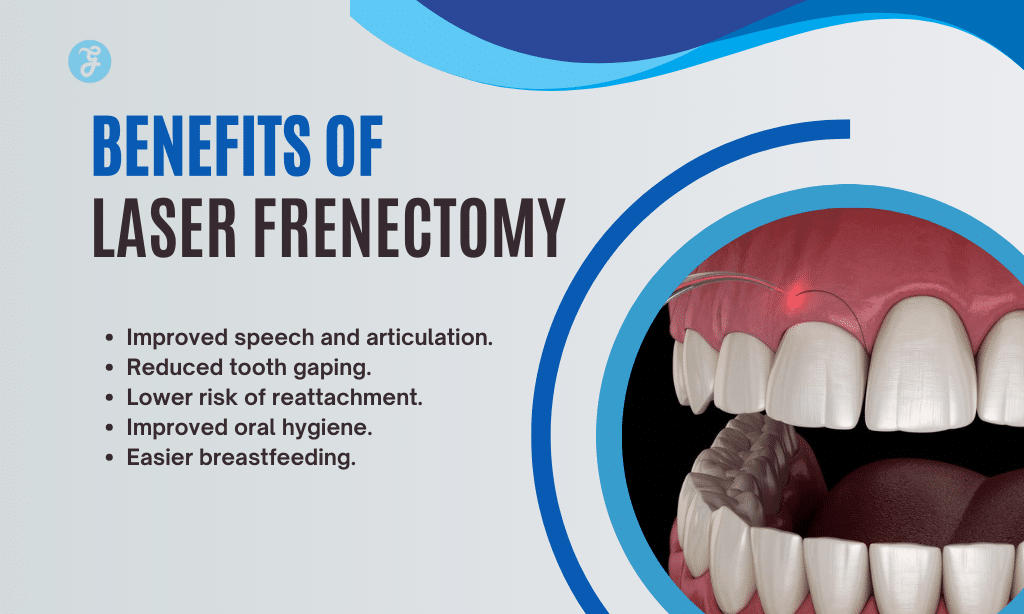 Benefits of laser frenectomy