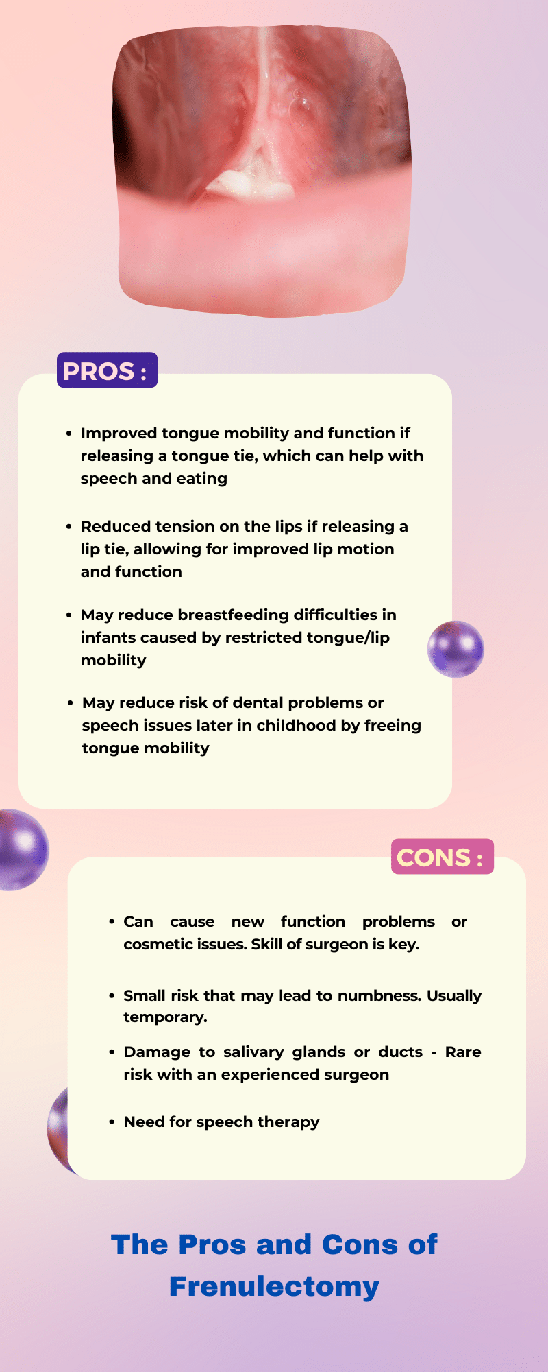 Pros and Cons of Frenulectomy