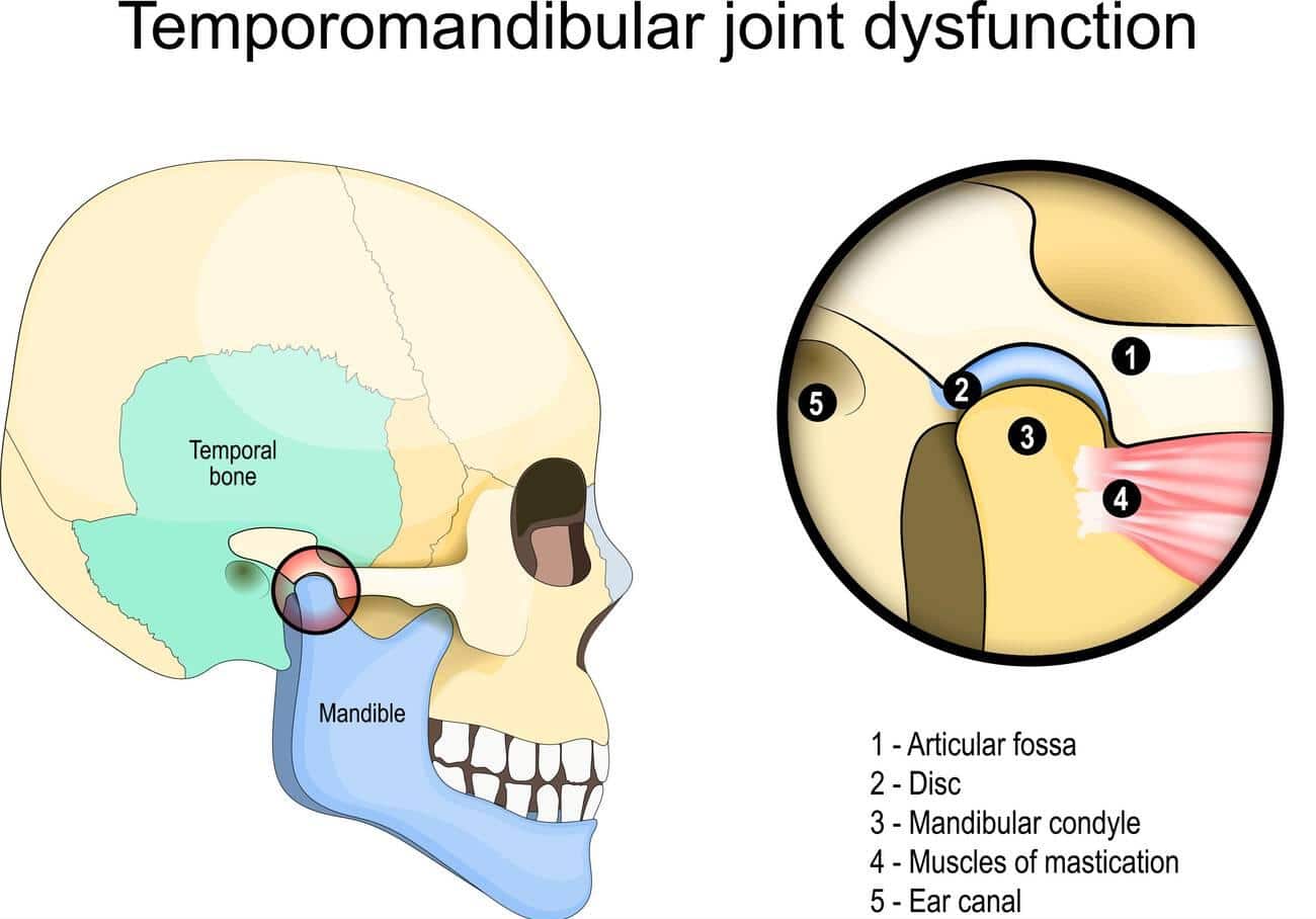 jaw misalignment