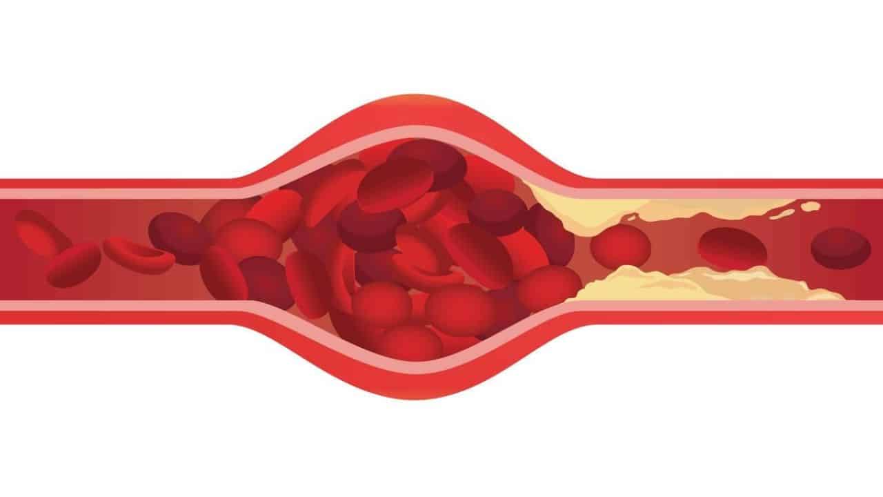 Things to Know About Cholesterol
