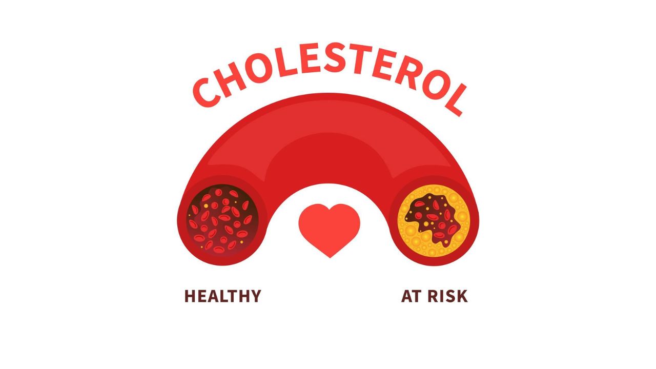 Things to Know About Cholesterol