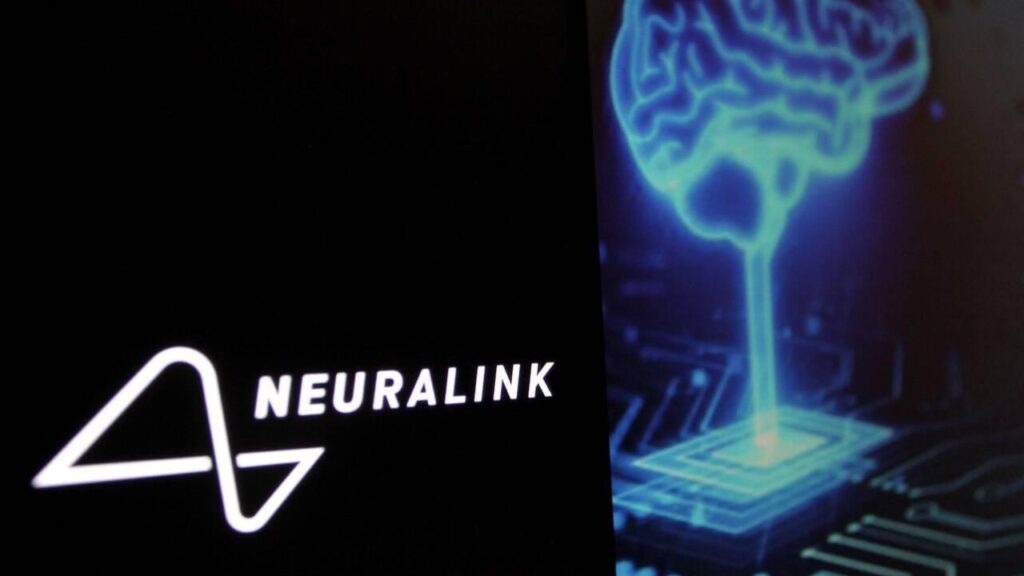 Neuralink First Brain Chip Scientists Reactions