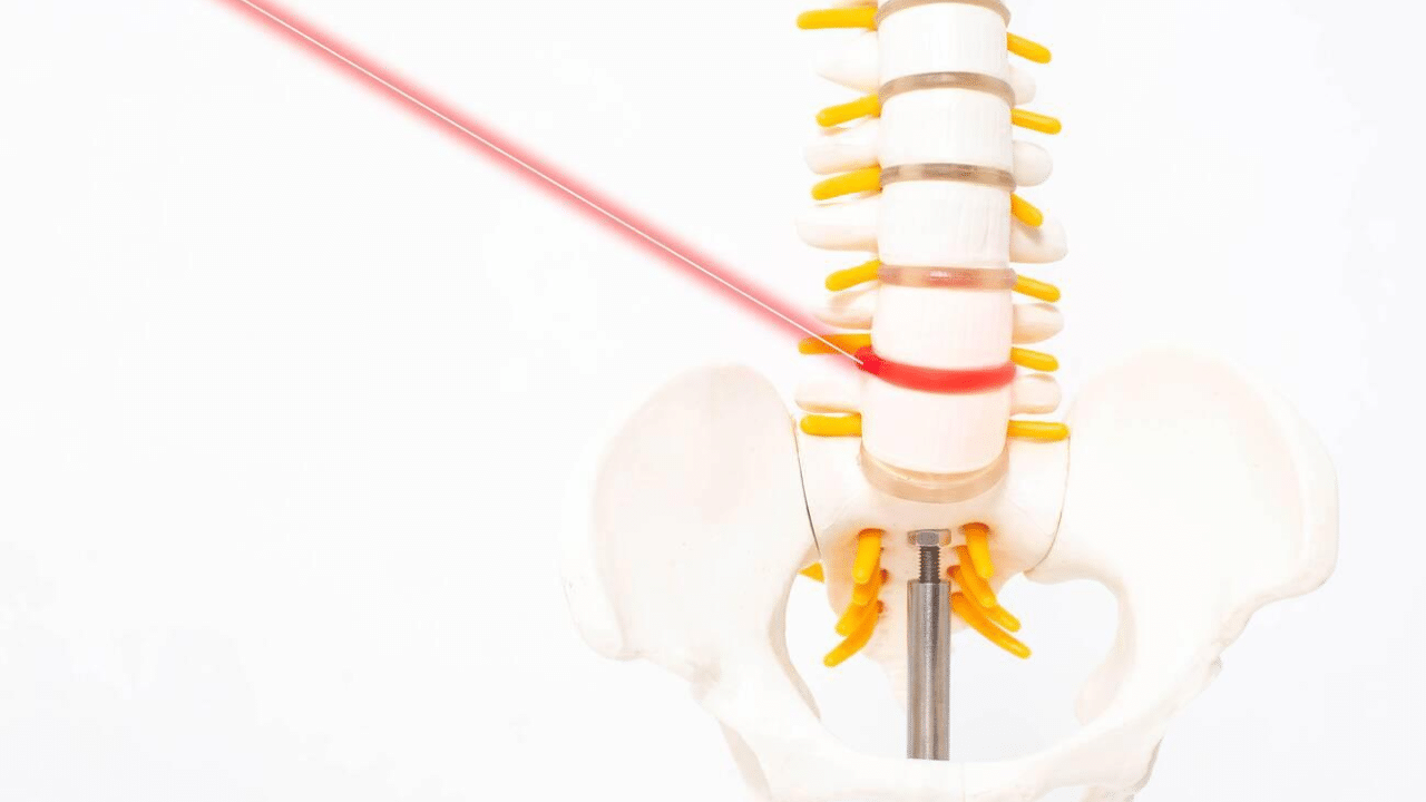 Mock up human spine on a white background with a laser. The concept of a new modern method without surgery for the treatment and removal of interverte