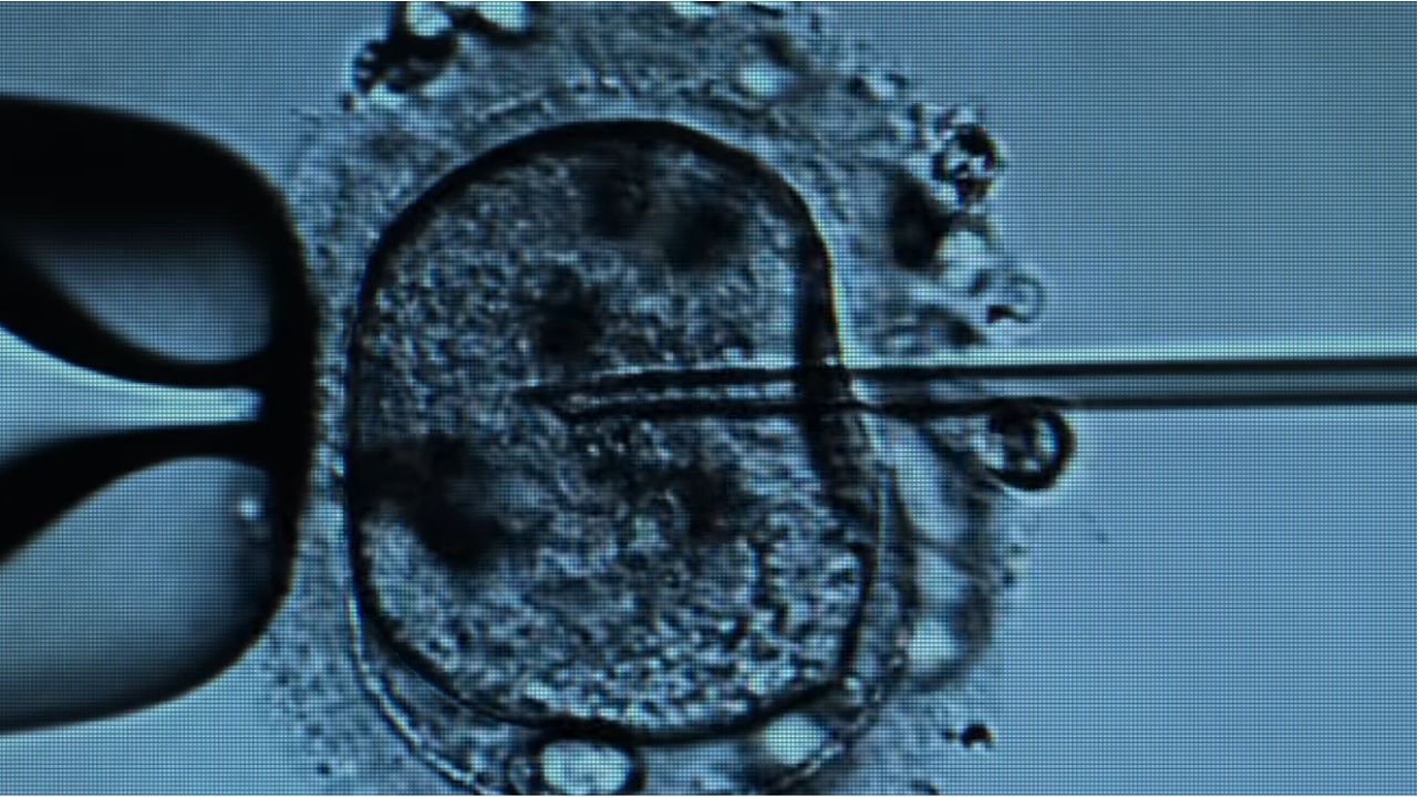 Robots AI Automate IVF Faster Easier Treatment