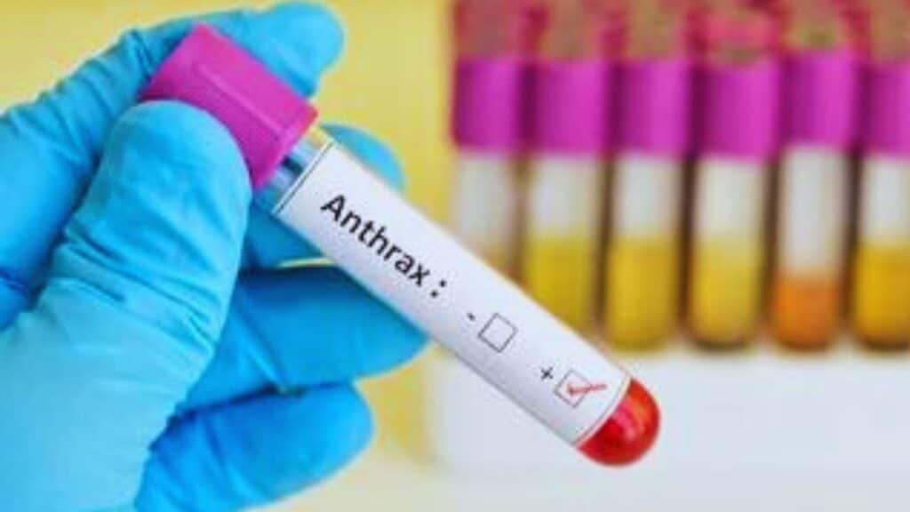 Anthrax in India