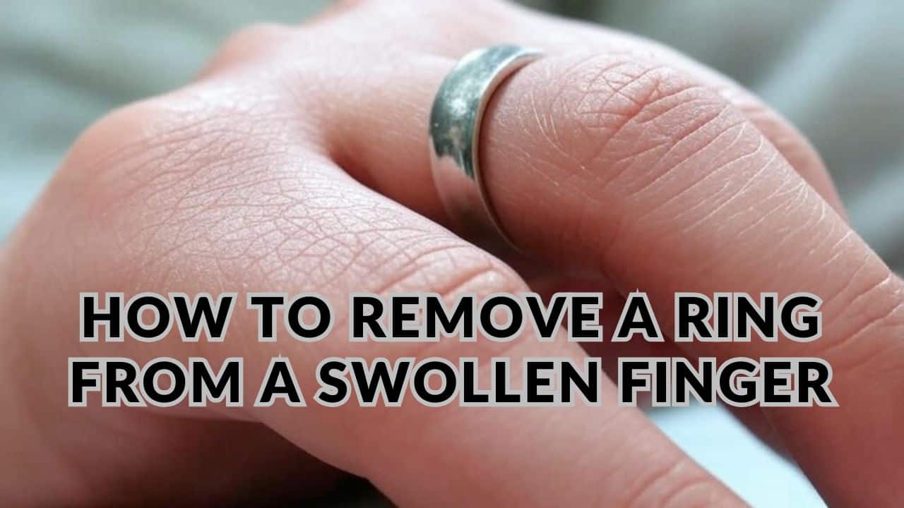 How to Remove a Ring From a Swollen Finger