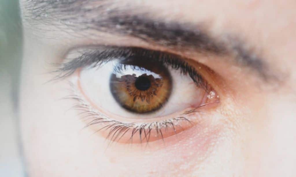 The different types of glaucoma