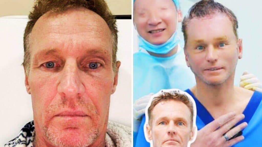 Australian tourist $4000 cosmetic surgery Vietnam