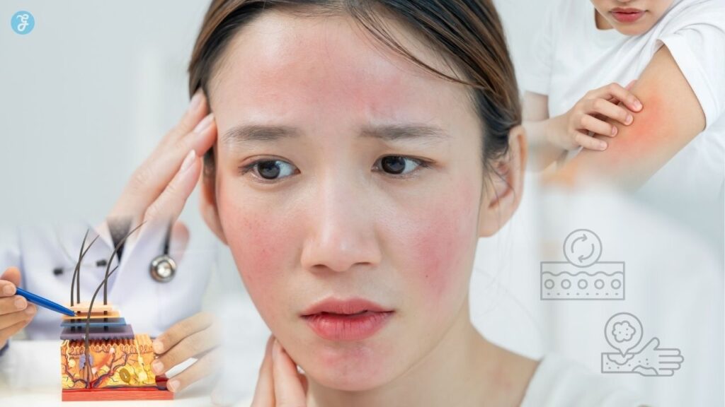 Skin Signs Of Internal Health Problems